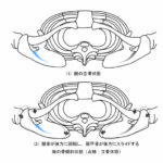図２−４ 腕の立骨状態と骨傾斜状態（上方視）